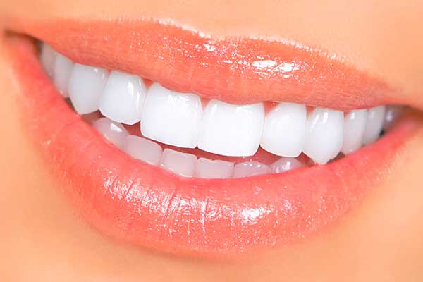 How Can I Keep My Veneers in Good Shape? - Dental Resorts