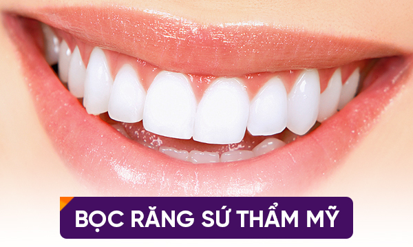 Bọc răng sứ thẩm mỹ - Phương pháp "Ưu Việt" phục hình răng hiệu quả