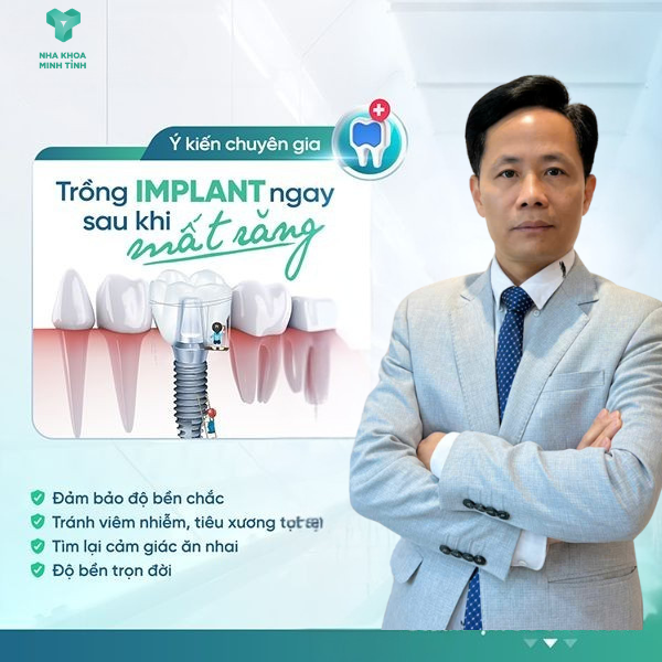 DR MINH TINH -IMPLANT